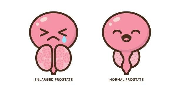 Cartoon benign and prostate vector illustration. Icon character of male urology inflammation disease. Flat design for diagram, medical journal article. Prostatitis, enlarged,obstruction,hypertrophy